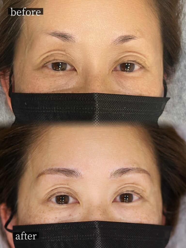 50代女性の眉アートメイク症例。昔抜きすぎて薄くなった眉中間から眉尻を自然に補い、緩やかで優しい印象に仕上げたナチュラル眉デザイン。